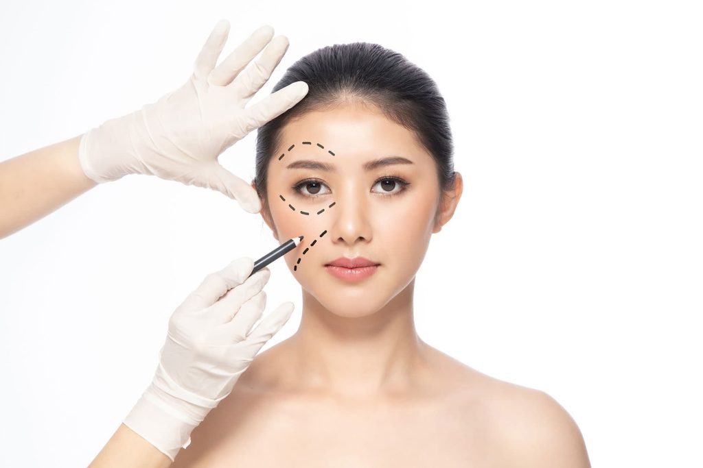 Woman before Eyelid Procedure