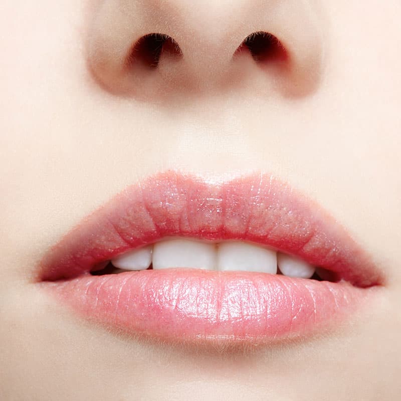 Close up of a woman's lips after lip reduction