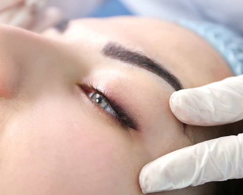Non-incisional eyelid procedure close-up