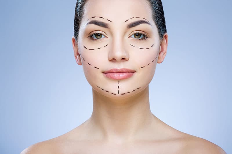 Woman before face fat grafting procedure