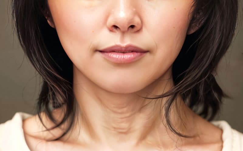 Close-up of woman's neck before neck lift