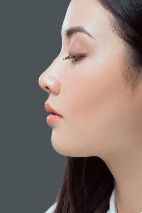 Side profile of woman after rhinoplasty